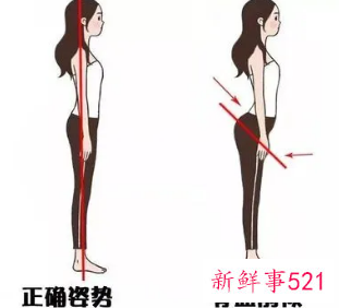 骨盆前倾的危害矫正后会改变吗