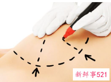 什么眼不适合割双眼皮