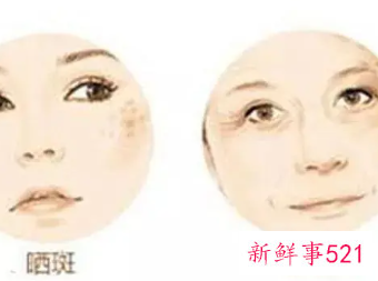 淡斑小秘诀有哪些