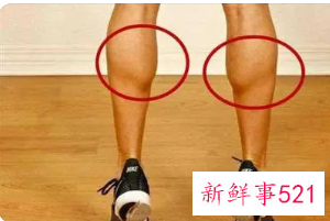 怎样快速减掉大腿肉呢