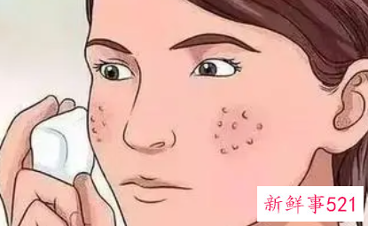 护肤强迫症有哪些