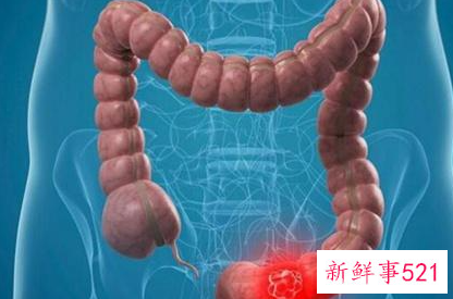 怎样做能快速排便