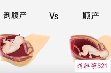 如何加快顺产产程