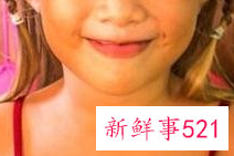 如何保养冬天最易干燥的那几个部位美容