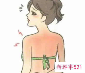 后背长痘痘是什么原因导致