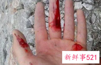 梦见自己喜欢的人满身是血