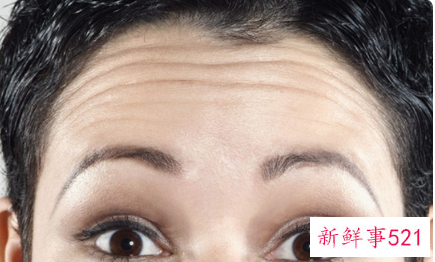 有抬头纹和鱼尾纹怎么办