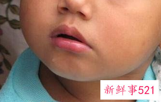 如何保养冬天最易干燥的那几个部位美容