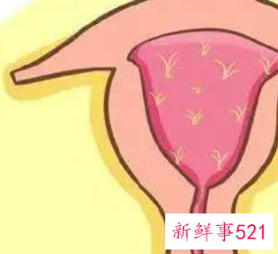 治疗妇科病为什么不能同房