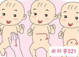 婴儿胀气最好的解决办法