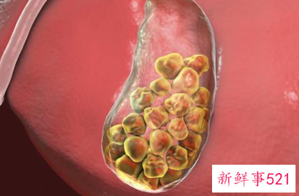 什么样的人群不适合吃人参