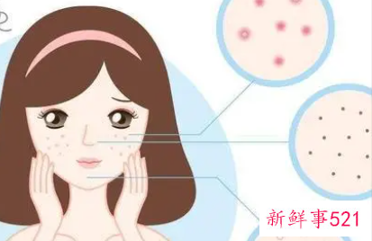 受损的肌肤如何挽救