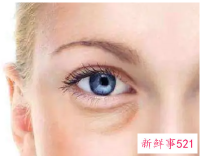 消除眼袋的小窍门