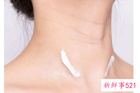 颈部有皱纹怎么办