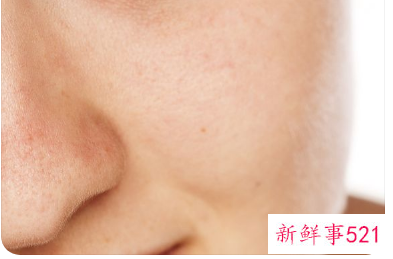 脸起很多小米粒