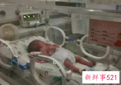 小孩不足月进保温箱一般要几天能出来