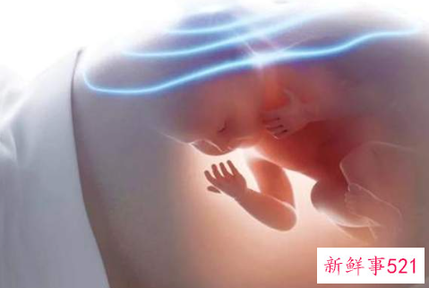 孕晚期导致早产的原因