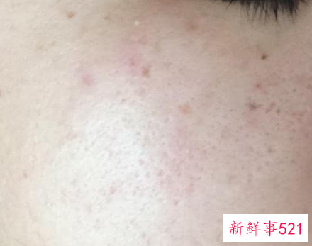 吃什么能淡化脸上的斑