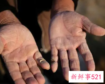 手干燥粗糙裂口怎么办