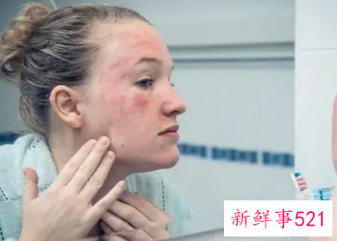 身上皮肤干燥起皮的原因