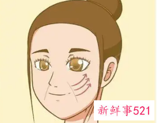 青少年法令纹怎么消除