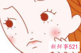 毛孔粗大堵塞黑头怎么治疗