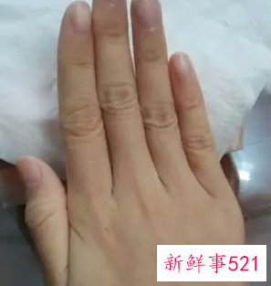 从小手就粗糙干燥皱纹多
