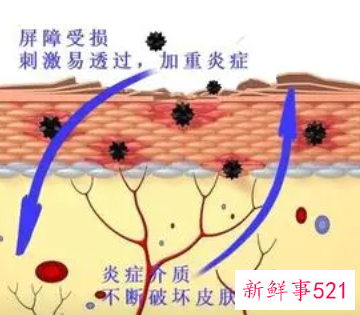 受损的肌肤如何挽救
