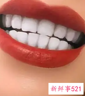 牙齿太黄了有什么办法弄白吗