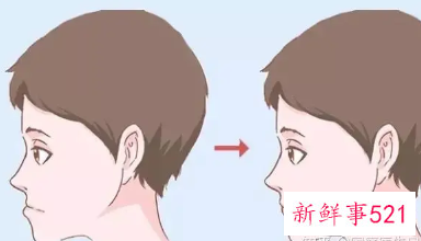 口呼吸20岁了还能矫正回来脸型吗