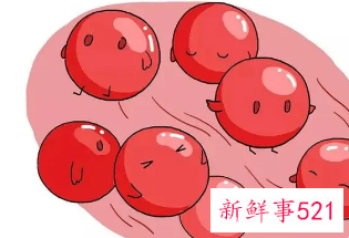 姨妈推迟量少颜色偏黑是怎么回事