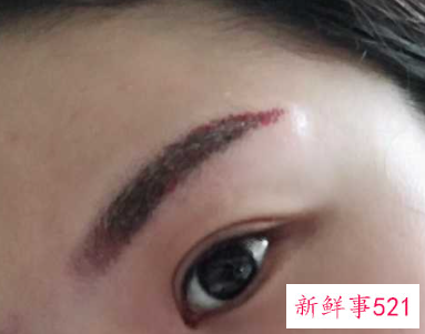 纹眉怎样淡化最快