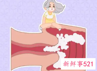 外阴瘙痒可以自愈吗