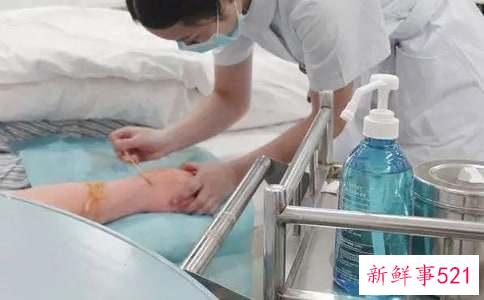 脚蜕皮怎么护理