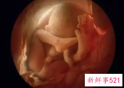 胎宝宝入盆是什么感觉