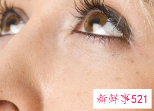 去皱的医美的方法