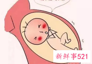 天气热孕妇喘不上气是缺氧吗