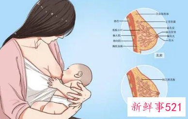 母乳喂养的原则是什么