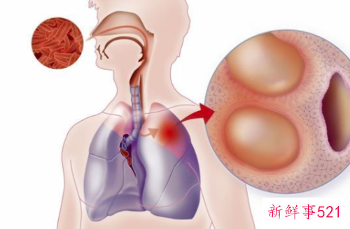 什么样的人群不适合吃人参