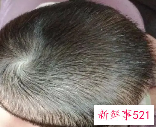 宝宝头向右歪怎么办