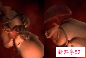 孕38周宝宝的样子