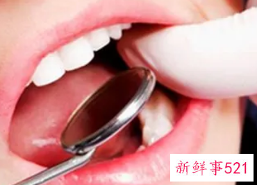 换牙期能吃糖吗