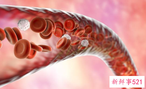 五个好习惯让血管健康常驻