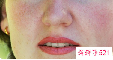 脸起很多小米粒