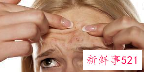 青春期脸上长痘痘怎么调理