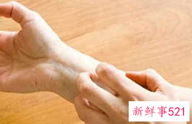 螨虫叮咬后的症状图