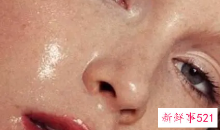 脸上出油严重是怎么回事