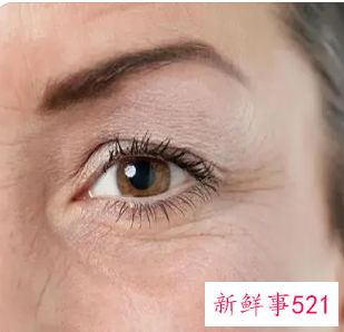 皱纹和干纹怎么区分