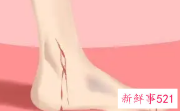 梦见孩子脚上长包什么意思