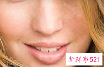 斑点如何淡化的小妙招